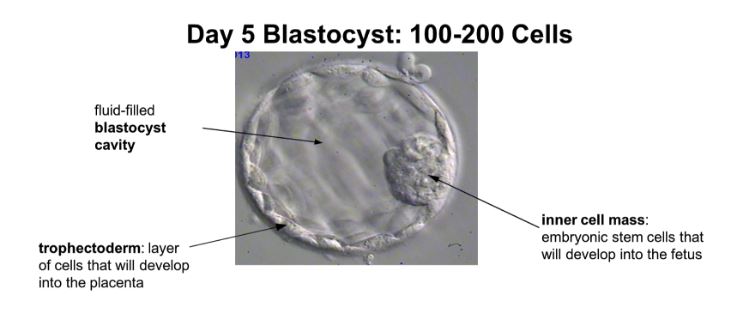 Blatsocyst