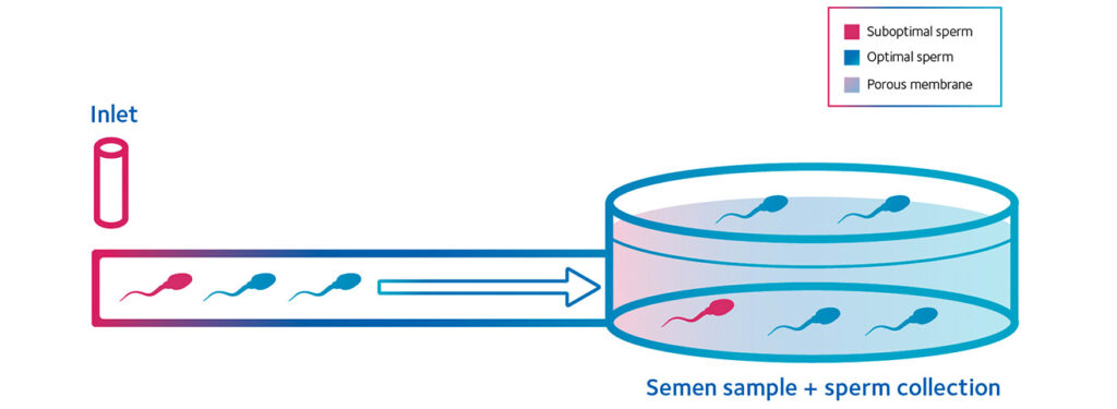 Zymot-IllustrationUpdate-R1_sperm-WEB